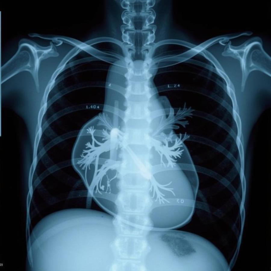 Dog Heart Size on X-Ray